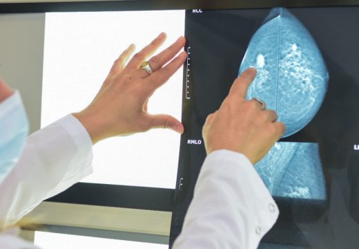 En el día de Sensibilización del Cáncer de Mama Salud recordó que la mamografía es el estudio indicado para la detección temprana.
